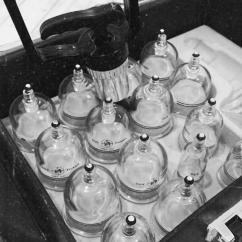 Massage Tradie Remedial - Vacuum Cupping