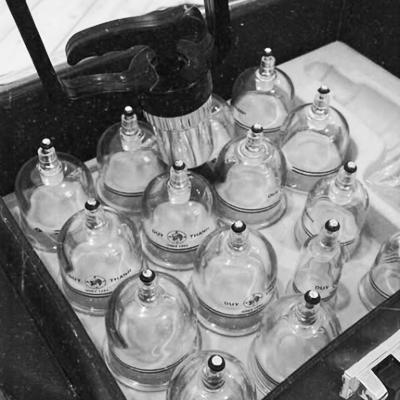 Massage Tradie Remedial - Vacuum Cupping